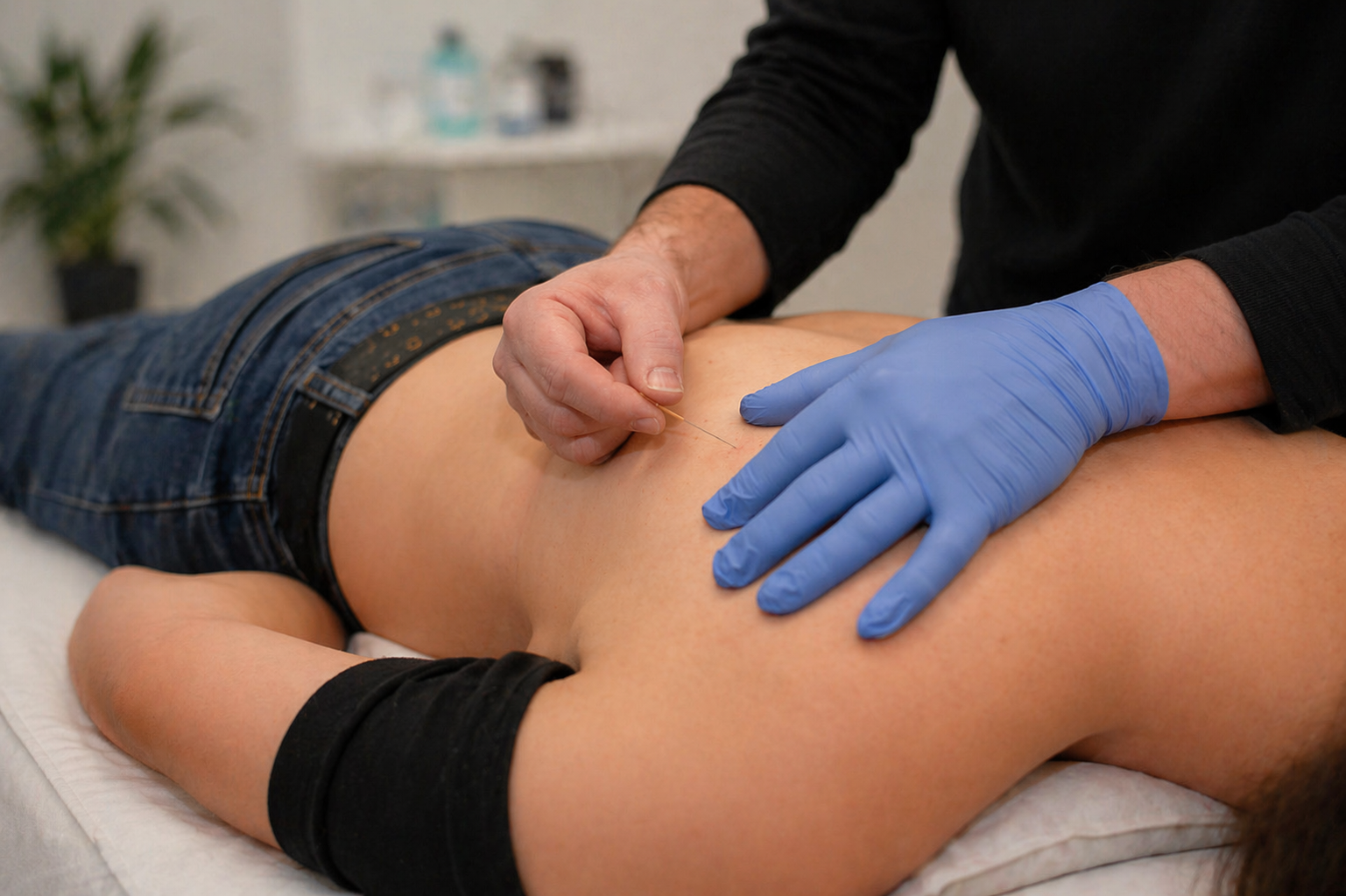 Dry needling- Fysio4 Selwerd - Groningen